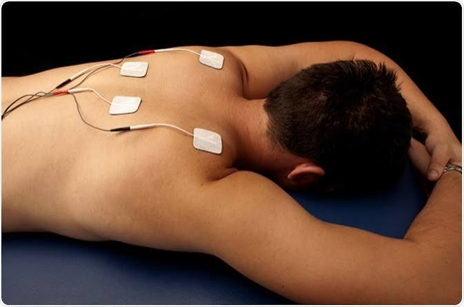 Electrotherapy pads applied to a patient's back during a physiotherapy treatment session