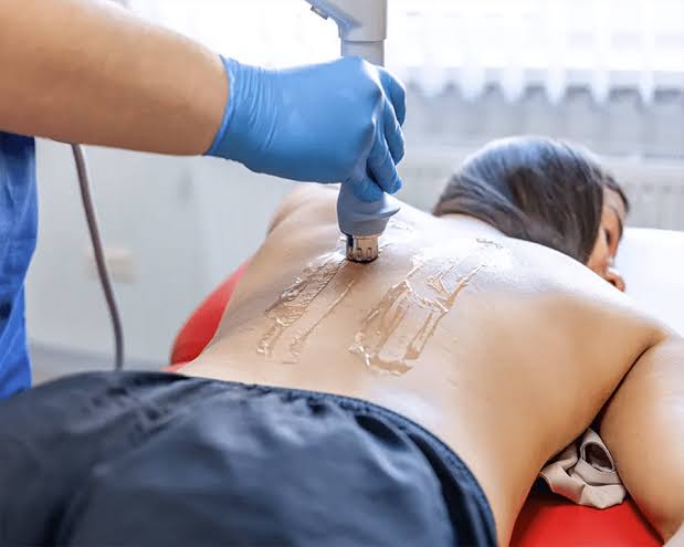 Physiotherapist applying a shockwave therapy applicator with coupling gel to a patient's lower back